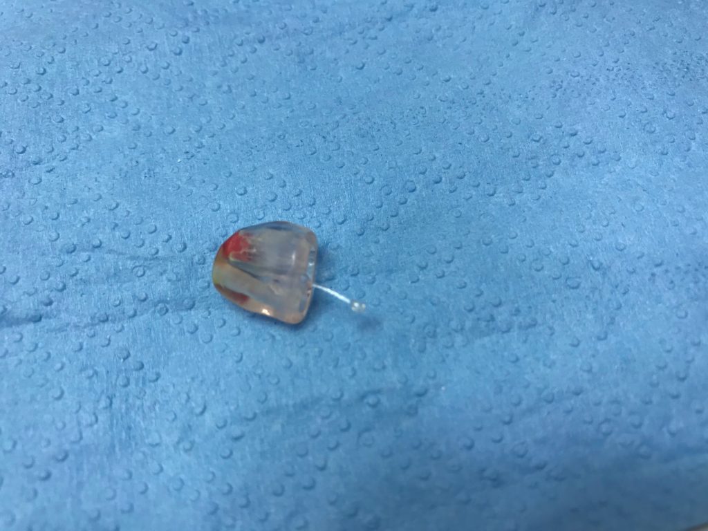 hilo extractor